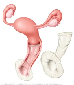 کاندوم سایز بزرگ و کاندوم زنانه