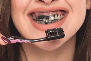 خمیر دندان زغال بنسر